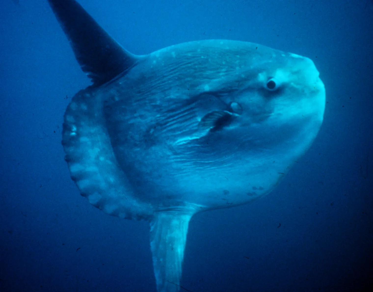 Common Mola