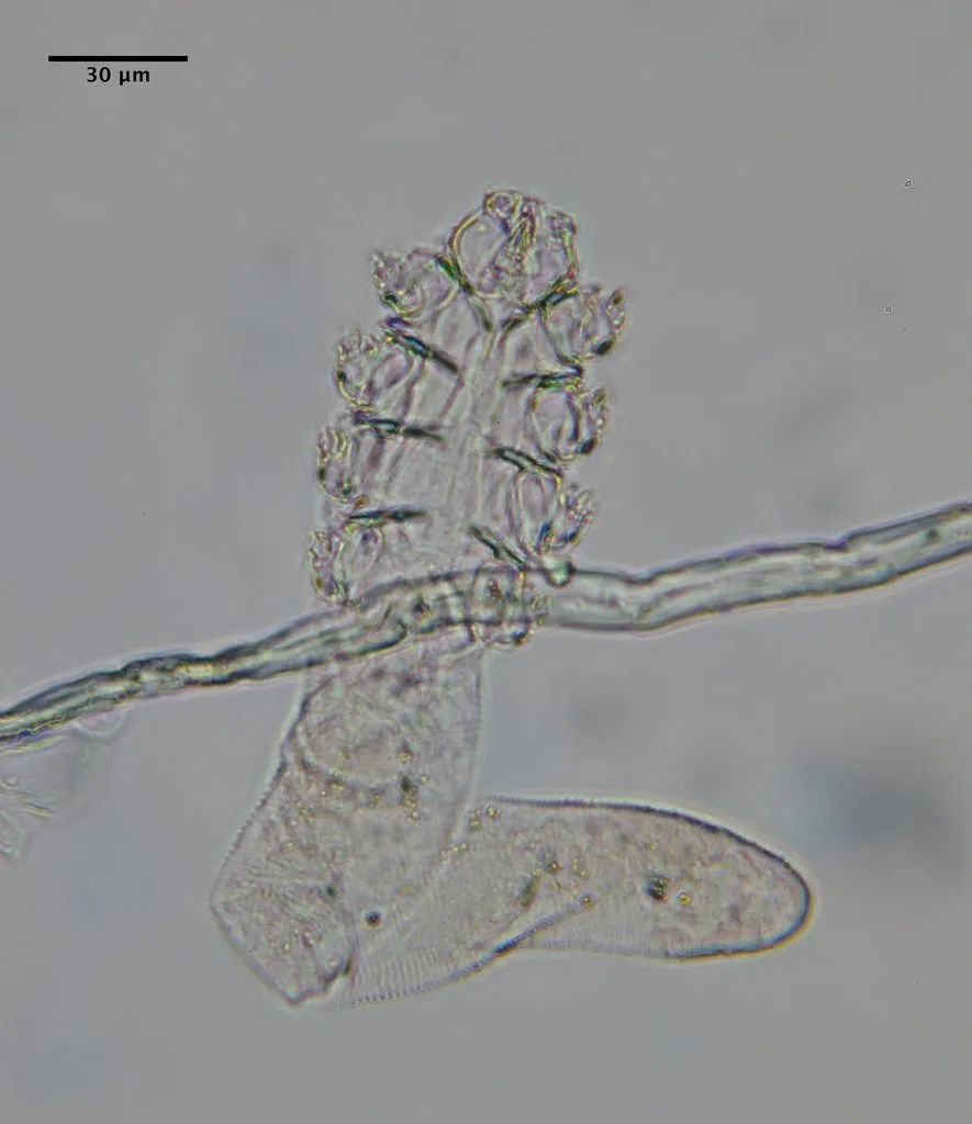 Human Follicle Mite