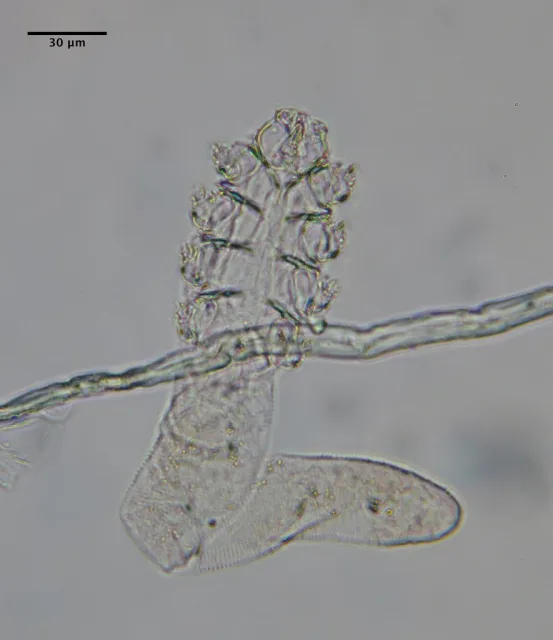 Demodex folliculorum